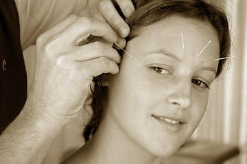 Akupunktur-Gesicht